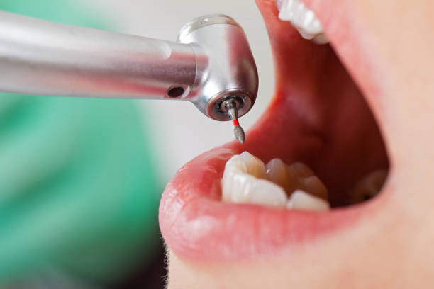 Best Mobile Emergency Dentist in Winston Salem, NC